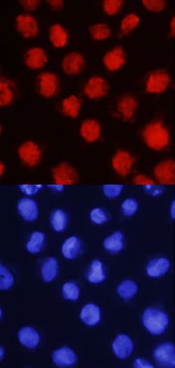 Human LMO2 Antibody, R D Systems 100&mu;g; Unlabeled:Antibodies, Polyclonal