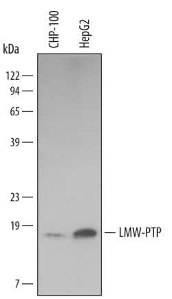 Human/Mouse/Rat LMW-PTP/ACP1 Antibody, R D Systems 100ug; Unlabeled:Antibodies,