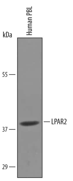 Human LPAR2 Antibody, R D Systems 100&mu;g; Unlabeled:Antibodies, Polyclonal