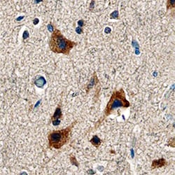 Human LRG1 Antibody, R D Systems 25&mu;g; Unlabeled:Antibodies, Polyclonal