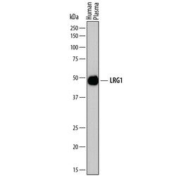 Human LRG1 Antibody, R D Systems 25&mu;g; Unlabeled:Antibodies, Polyclonal