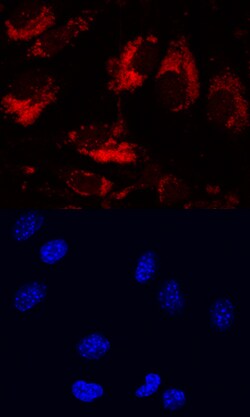 Mouse LRIG1 Antibody, R D Systems 25&mu;g; Unlabeled:Antibodies, Polyclonal