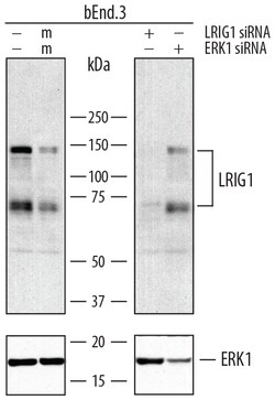 Mouse LRIG1 Antibody, R D Systems 25&mu;g; Unlabeled:Antibodies, Polyclonal