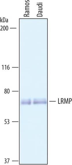 Human LRMP Antibody, R D Systems 25&mu;g; Unlabeled:Antibodies, Polyclonal