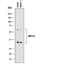 Human LRP-11 Antibody, R D Systems 25&mu;g; Unlabeled:Antibodies, Polyclonal
