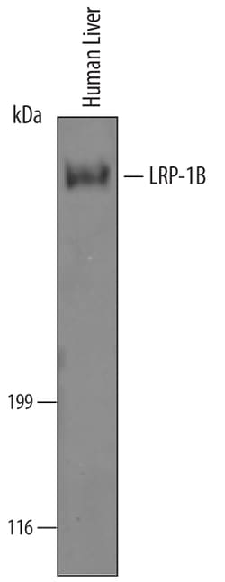Human LRP-1B Antibody, R D Systems 100&mu;g; Unlabeled:Antibodies, Polyclonal