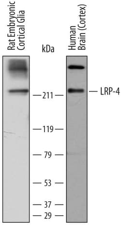Human LRP-4 Antibody, R D Systems 25 &mu;g | Buy Online | R&D Systems | Fisher Scientific