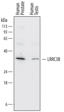 Human LRRC3B Antibody, R D Systems 100ug; Unlabeled:Antibodies, Monoclonal