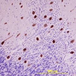 Human LRRC4 Antibody, R D Systems 25&mu;g; Unlabeled:Antibodies, Polyclonal