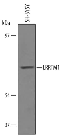 Human LRRTM1 Antibody, R D Systems 25&mu;g; Unlabeled:Antibodies, Polyclonal