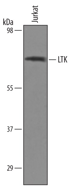 Human LTK Antibody, R D Systems 25&mu;g; Unlabeled:Antibodies, Polyclonal