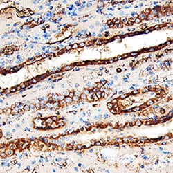 Human Lumican Antibody, R D Systems 100&mu;g; Unlabeled:Antibodies, Polyclonal