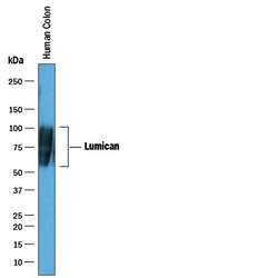 Human Lumican Antibody, R D Systems 100&mu;g; Unlabeled:Antibodies, Polyclonal
