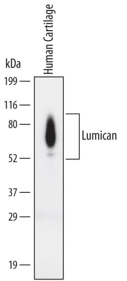 Human/Mouse Lumican Antibody, R D Systems 100ug; Unlabeled:Antibodies,