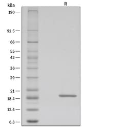 R D Systems Recombinant Human Lymphotoxin-alpha/TNF-beta Protein 10 &mu;g | Buy Online | R&amp;D Systems&trade; | Fisher Scientific