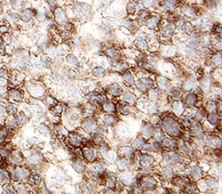 Human Lyp Antibody, R D Systems 100ug; Unlabeled:Antibodies, Monoclonal