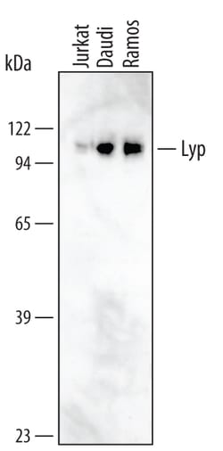 Human Lyp Antibody, R D Systems 100ug; Unlabeled:Antibodies, Monoclonal