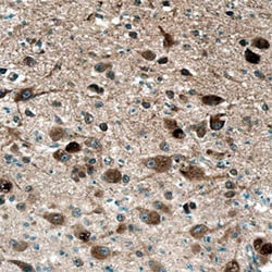 Human LYPD1 Antibody, R D Systems 100&mu;g; Unlabeled:Antibodies, Polyclonal