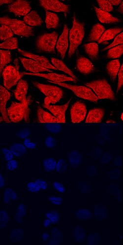 Human Lysine (K)-specific Demethylase 4C/KDM4C Antibody, R D Systems 25&mu;g;