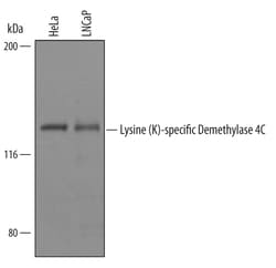 Human Lysine (K)-specific Demethylase 4C/KDM4C Antibody, R D Systems 25&mu;g;