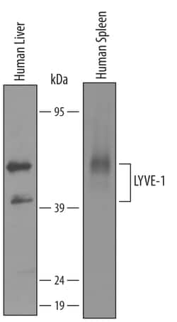 Human LYVE-1 Antibody, R D Systems 100&mu;g; Unlabeled:Antibodies, Polyclonal
