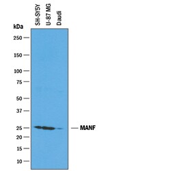 Human MANF Antibody, R D Systems 25&mu;g; Unlabeled:Antibodies, Polyclonal