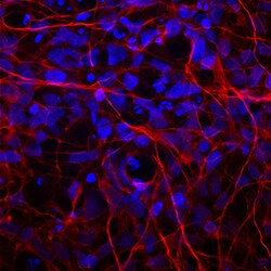 Human MAP2 Antibody, R D Systems:Antibodies:Primary Antibodies