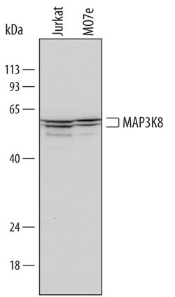 Human MAP3K8/Tpl2/COT Antibody, R D Systems 100ug; Unlabeled:Antibodies,