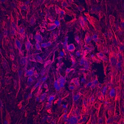 Human Matrilin-1 Antibody, R D Systems 25 &mu;g | Buy Online | R&D Systems | Fisher Scientific