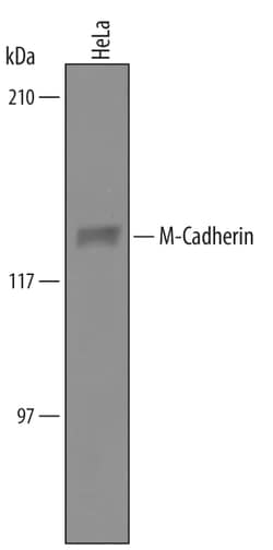 Human M-Cadherin/Cadherin-15 Antibody, R D Systems 25&mu;g; Unlabeled:Antibodies,