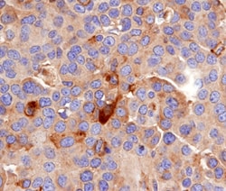 Human MDL-1/CLEC5A Antibody, R D Systems 100&mu;g; Unlabeled:Antibodies,