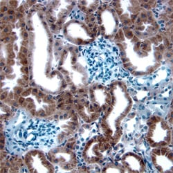 Human/Mouse/Rat MDM2/HDM2 Antibody, R D Systems 100&mu;g; Unlabeled:Antibodies,
