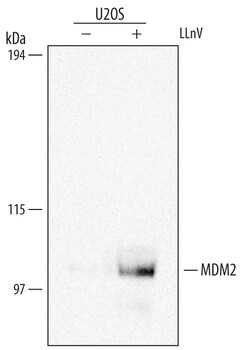 Human MDM2/HDM2 Antibody, R D Systems 25&mu;g; Unlabeled:Antibodies, Monoclonal