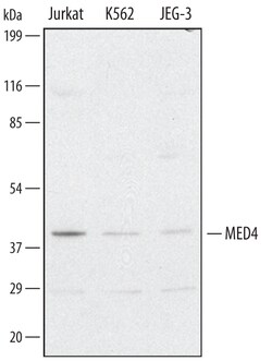 Human MED4 Antibody, R D Systems 100&mu;g; Unlabeled:Antibodies, Polyclonal