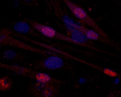 Human/Mouse MEF2C Antibody, R D Systems 25&mu;g; Unlabeled:Antibodies,