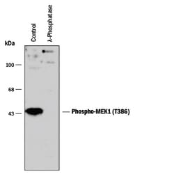 Human Phospho-MEK1 (T386) Antibody, R D Systems 100&mu;L; Unlabeled:Antibodies,