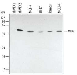 Human MEK2 Antibody, R D Systems 25&mu;g; Unlabeled:Antibodies, Polyclonal