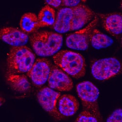 Human/Mouse/Rat MEKK2 Antibody, R D Systems 100ug; Unlabeled:Antibodies,