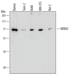 Human/Mouse/Rat MEKK2 Antibody, R D Systems 100ug; Unlabeled:Antibodies,