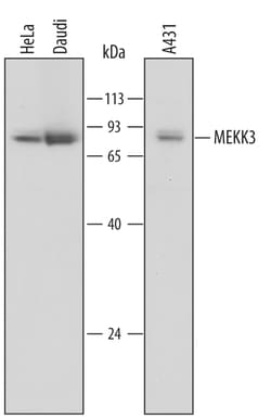 Human MEKK3 Antibody, R D Systems 100ug; Unlabeled:Antibodies, Monoclonal