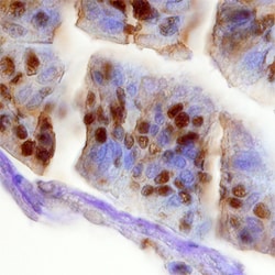 Human MELK Antibody, R D Systems 100&mu;g; Unlabeled:Antibodies, Polyclonal