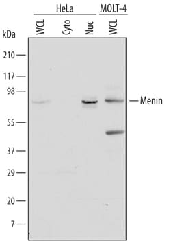 Human Menin Antibody, R D Systems 25 &mu;g | Buy Online | R&D Systems | Fisher Scientific