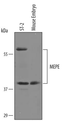 Mouse MEPE/OF45 Antibody, R D Systems 100 &mu;g | Buy Online | R&D Systems | Fisher Scientific