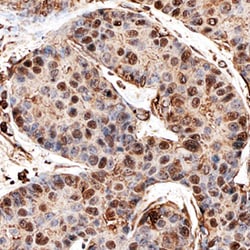 Human MERIT40 Antibody, R D Systems 100&mu;g; Unlabeled:Antibodies, Polyclonal