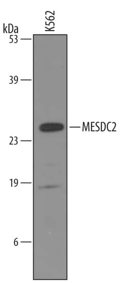 Human MESDC2 Antibody, R D Systems 100&mu;g; Unlabeled:Antibodies, Polyclonal