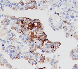 Human Mesothelin Antibody, R D Systems 25&mu;g; Unlabeled:Antibodies, Monoclonal