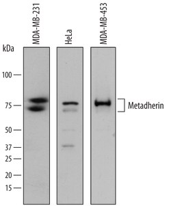 Metadherin Sheep anti-Human, Polyclonal, R D Systems 25&mu;g; Unlabeled,
