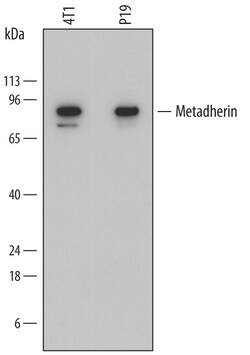 Mouse Metadherin Antibody, R D Systems 25 &mu;g | Buy Online | R&D Systems | Fisher Scientific