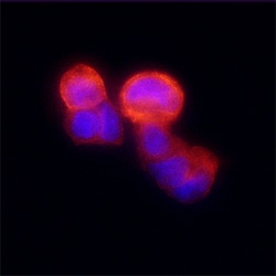 Human N-Acetylglucosaminyltransferase V/MGAT5 Antibody, R D Systems 100ug;