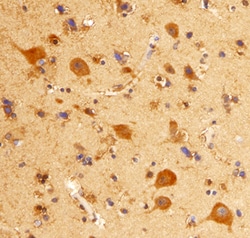 Human mGluR8 Antibody, R D Systems 25&mu;g; Unlabeled:Antibodies, Monoclonal
